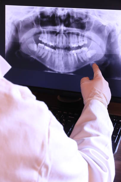 Best Emergency Wisdom Teeth Removal in Altamont, NY